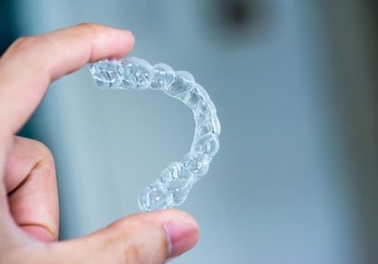 Can Invisalign Fix Overbites, Underbites, or Crossbites?