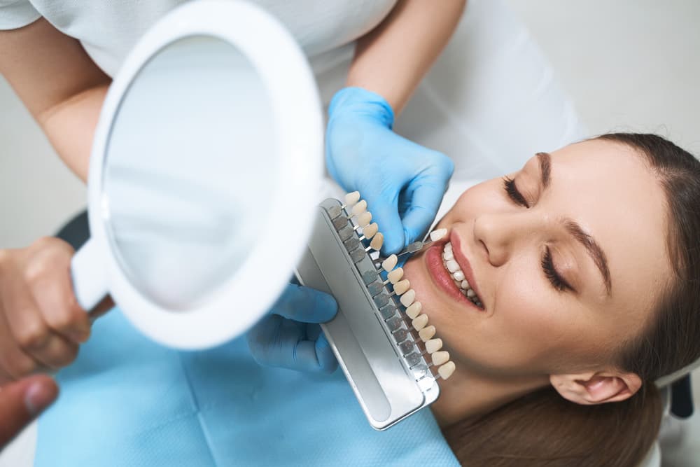 porcelain veneers